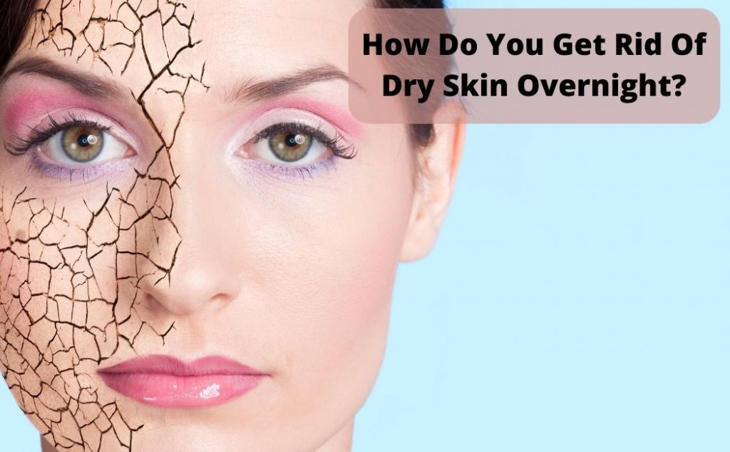 How Do You Get Rid Of Dry Skin Overnight