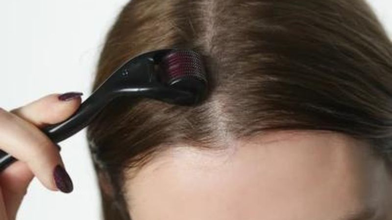 Does Derma Roller Work For Hair?