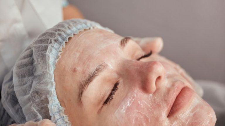 Acne laser treatment in Lahore