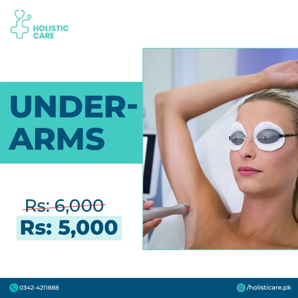Under Arms Laser Hair Removal