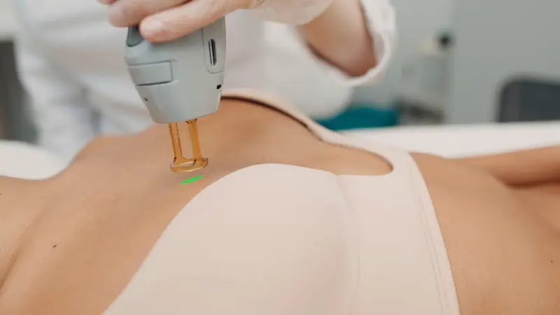 laser hair removal for breasts