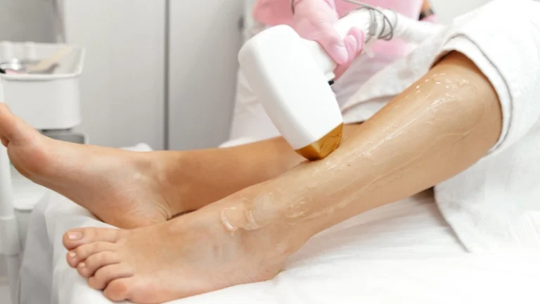 Benefits of Laser Hair Removal